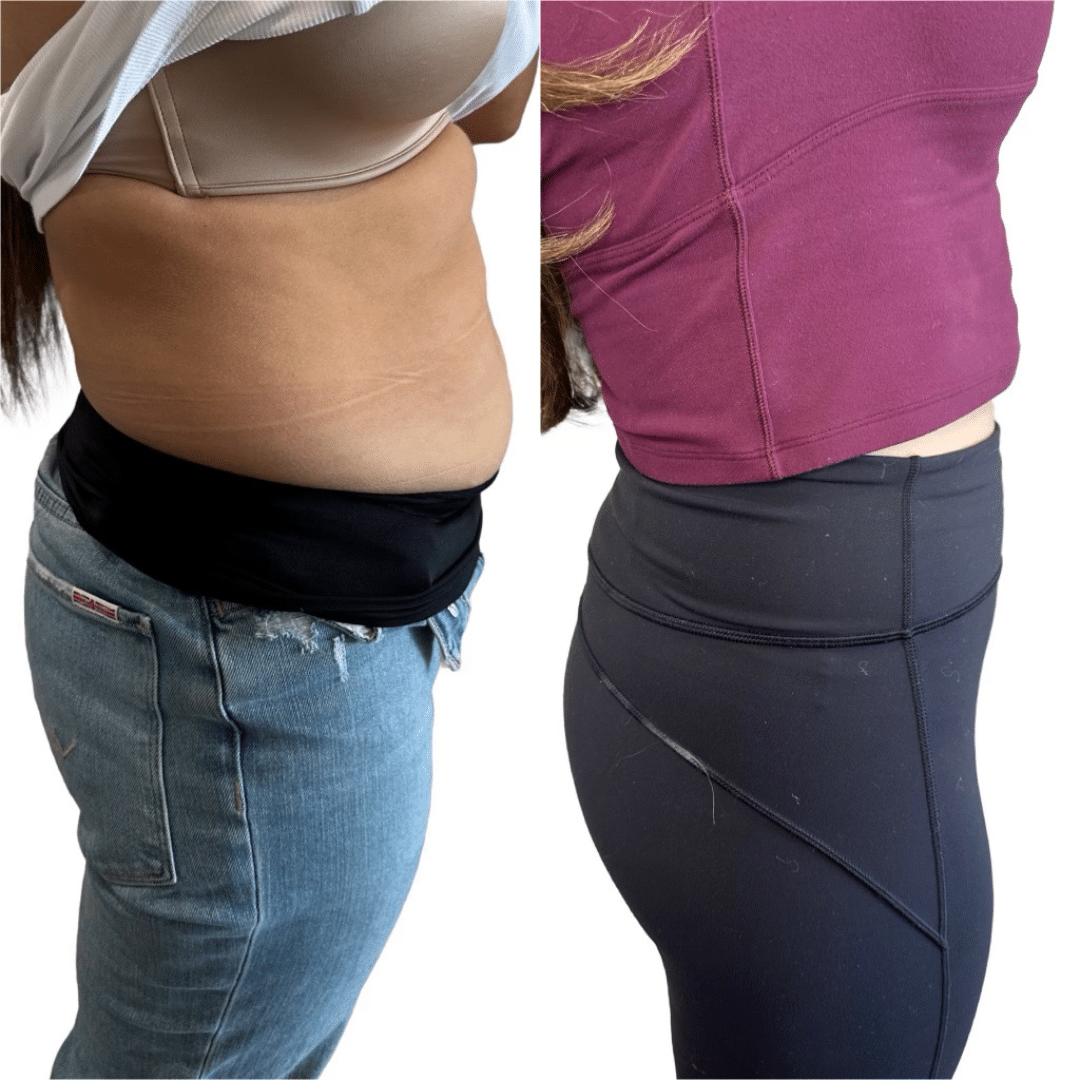 Before and After Image: Weight Loss – Ozempic - right-side